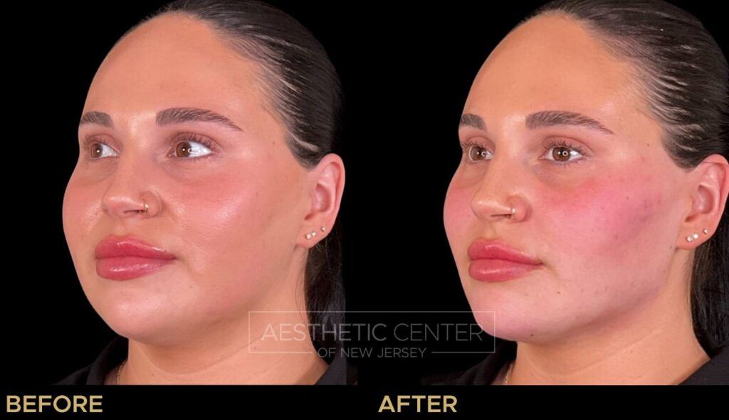facial balancing near me